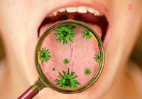 ویروس کرونا چه تاثیری بر دهان و دندان می‌گذارد؟