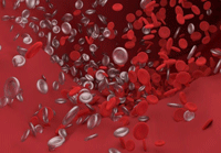 آنتی‌بادی‌های سرکش لخته‌های خون در مبتلایان به کووید-۱۹ ایجاد می‌کند