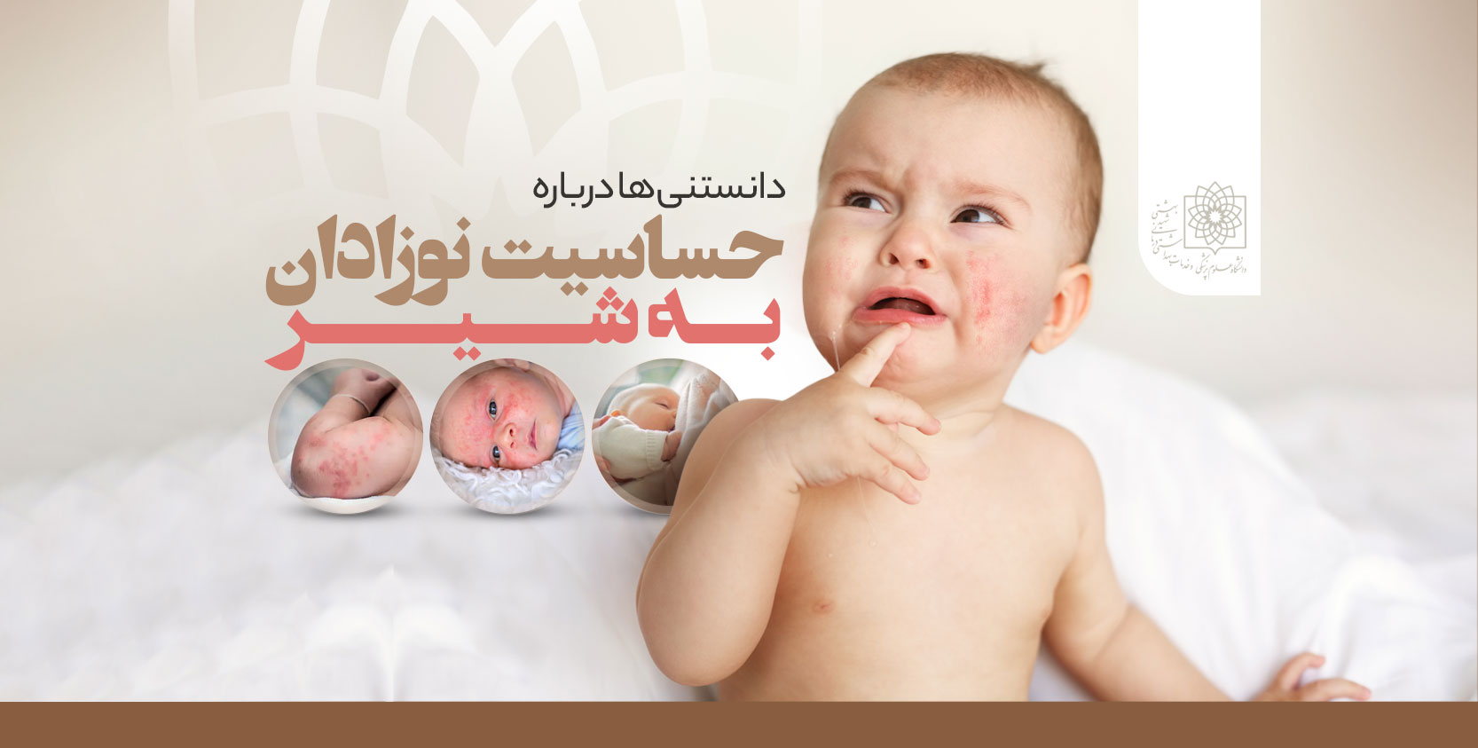 آنچه باید درباره حساسیت به لبنیات در نوزادان و شیرخواران بدانید